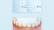 Ирригатор Xiaomi Mijia Electric Tooth Irrigator F300 Белый - Изображение 236473