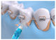 Ирригатор Soocas Portable Oral Irrigator W3 (4 насадки) - Изображение 120894