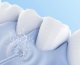 Ирригатор Dr.Bei Water Flosser YMYM-YF3 - Изображение 164105